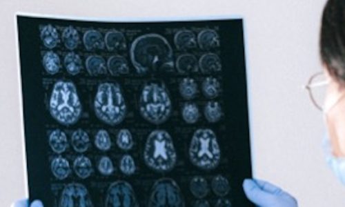 Reading political games through neuroscience